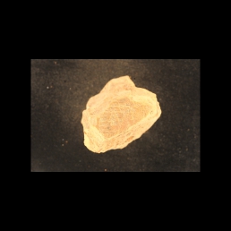 RTI (reverse)